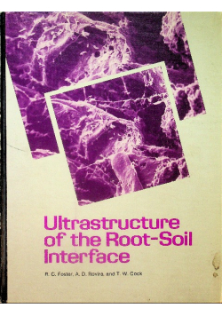 Ultrastructure of the Root Soil Interface