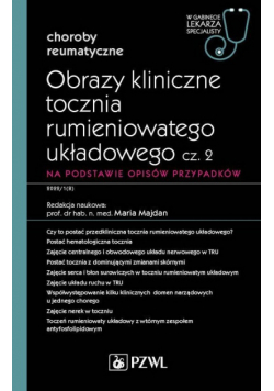 Obrazy kliniczne tocznia rumieniowatego układowego Część 2