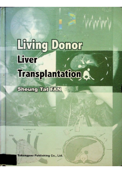 Living Donor Liver Transplantation