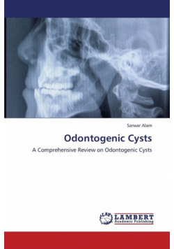 Odontogenic Cysts