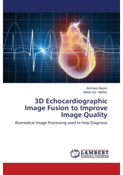 3D Echocardiographic Image Fusion to Improve Image Quality
