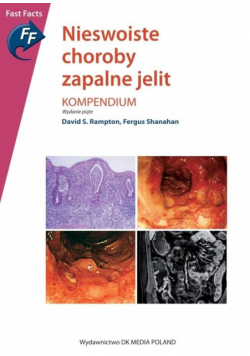 Nieswoiste choroby zapalne jelit