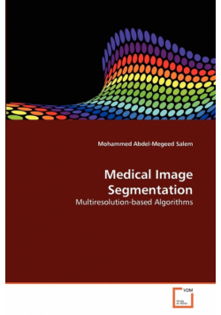 Medical Image Segmentation