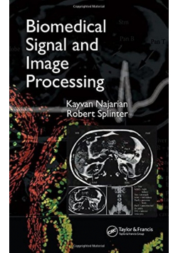 Biomedical Signal and Image Processing