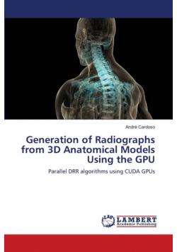 Generation of Radiographs from 3D Anatomical Models Using the GPU