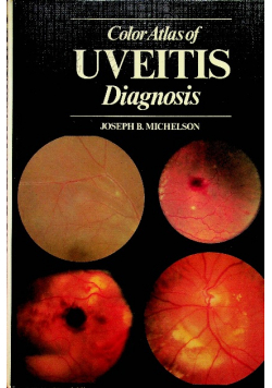 Colour atlas of uveitis diagnosis