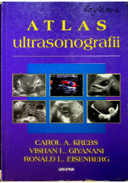 Atlas ultrasonografii