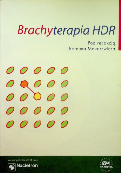 Brachyterapia HDR