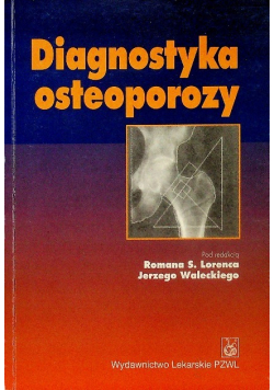 Diagnostyka osteoporozy