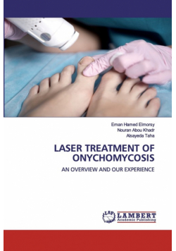 Laser Treatment Of Onychomycosis