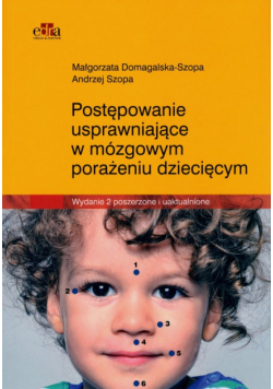 Postępowanie usprawniające w mózgowym porażeniu dziecięcym