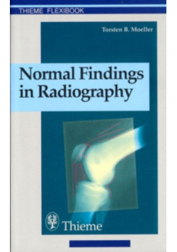 Normal Findings in Radiography