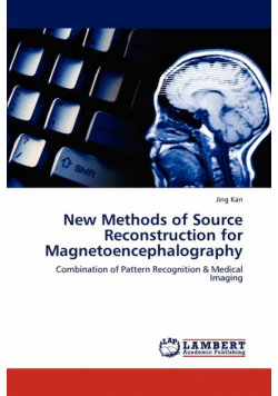 New Methods of Source Reconstruction for Magnetoencephalography