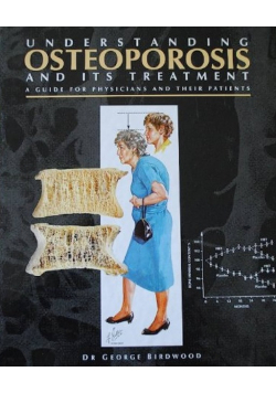 Understanding Osteoporosis and Its Treatment