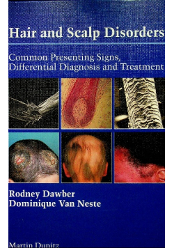 Hair and Scalp Disorders