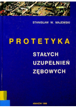 Protetyka stałych uzupełnień zębowych