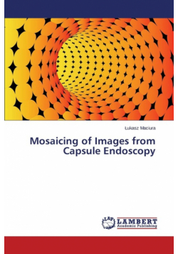 Mosaicing of Images from Capsule Endoscopy