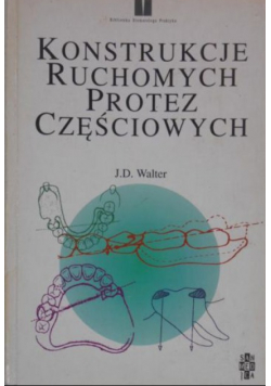 Konstrukcje ruchomych protez częściowych