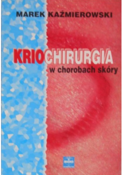 Kriochirurgia w chorobach skóry