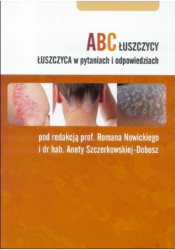 ABC łuszczycy Łuszczyca w pytaniach i odpowiedziach