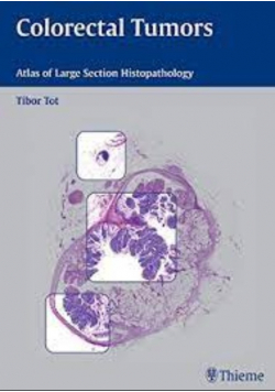 Colorectal Tumors Atlas of Large Section Histopathology