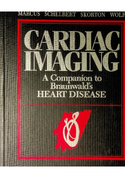Cardiac imaging