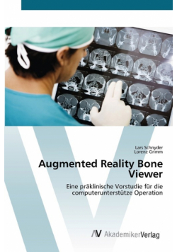 Augmented Reality Bone Viewer