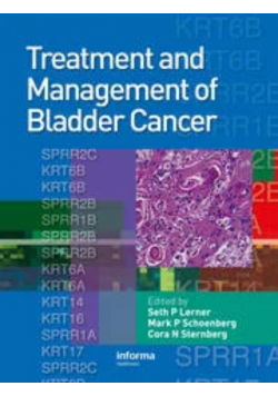 Treatment and Management of Bladder cancer