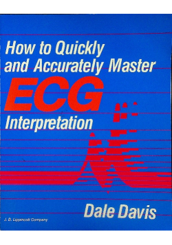 How to quickly and accurately master ecg