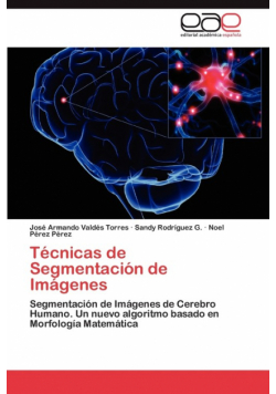 Tecnicas de Segmentacion de Imagenes