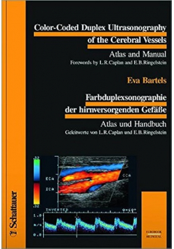 Color Coded Duplex Ultrasonography of the Cerebral Vessels