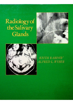 Radiology of the salivary glands
