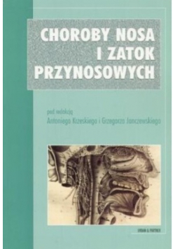 Choroby nosa i zatok przynosowych