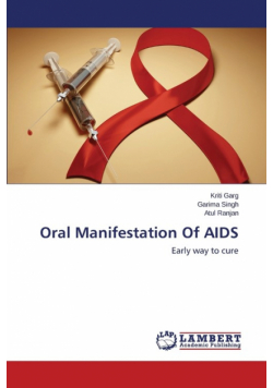 Oral Manifestation Of AIDS