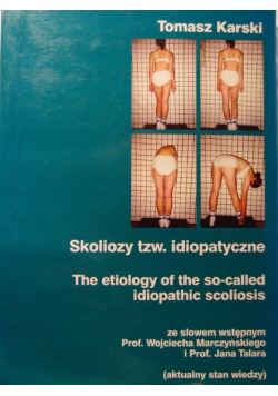 Skoliozy tzw idiopatyczne