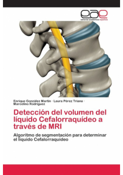 Detección del volumen del líquido Cefalorraquídeo a través de MRI