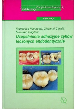 Uzupełnienia adhezyjne zębów