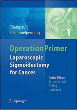 Laparoscopic Sigmoidectomy for Diverticulitis
