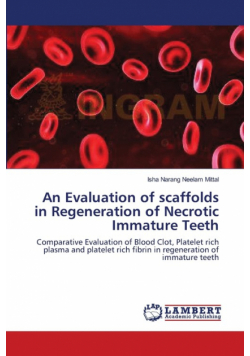 An Evaluation of scaffolds in Regeneration of Necrotic Immature Teeth