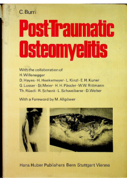Post - Traumatic Osteomyelitis