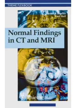 Normal Findings in CT and MRI