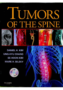 Tumors of the Spine z CD