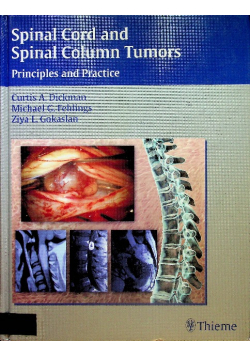 Spinal Cord and Spinal Column Tumors