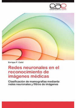 Redes Neuronales En El Reconocimiento de Imagenes Medicas
