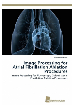 Image Processing for Atrial Fibrillation Ablation Procedures