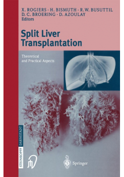 Split liver transplantation