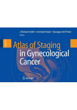 Atlas Of Staging In Gynecological Cancer