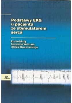 Podstawy EKG u pacjenta ze stymulatorem serca
