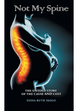 Not My Spine