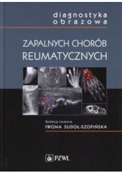 Diagnostyka obrazowa zapalnych chorób reumatycznych